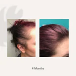 ACTIIV RECOVER Traitement Shampooing Épaississant pour Femme - Image 4