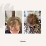 ACTIIV RECOVER Traitement Shampooing Épaississant pour Femme - Image 6