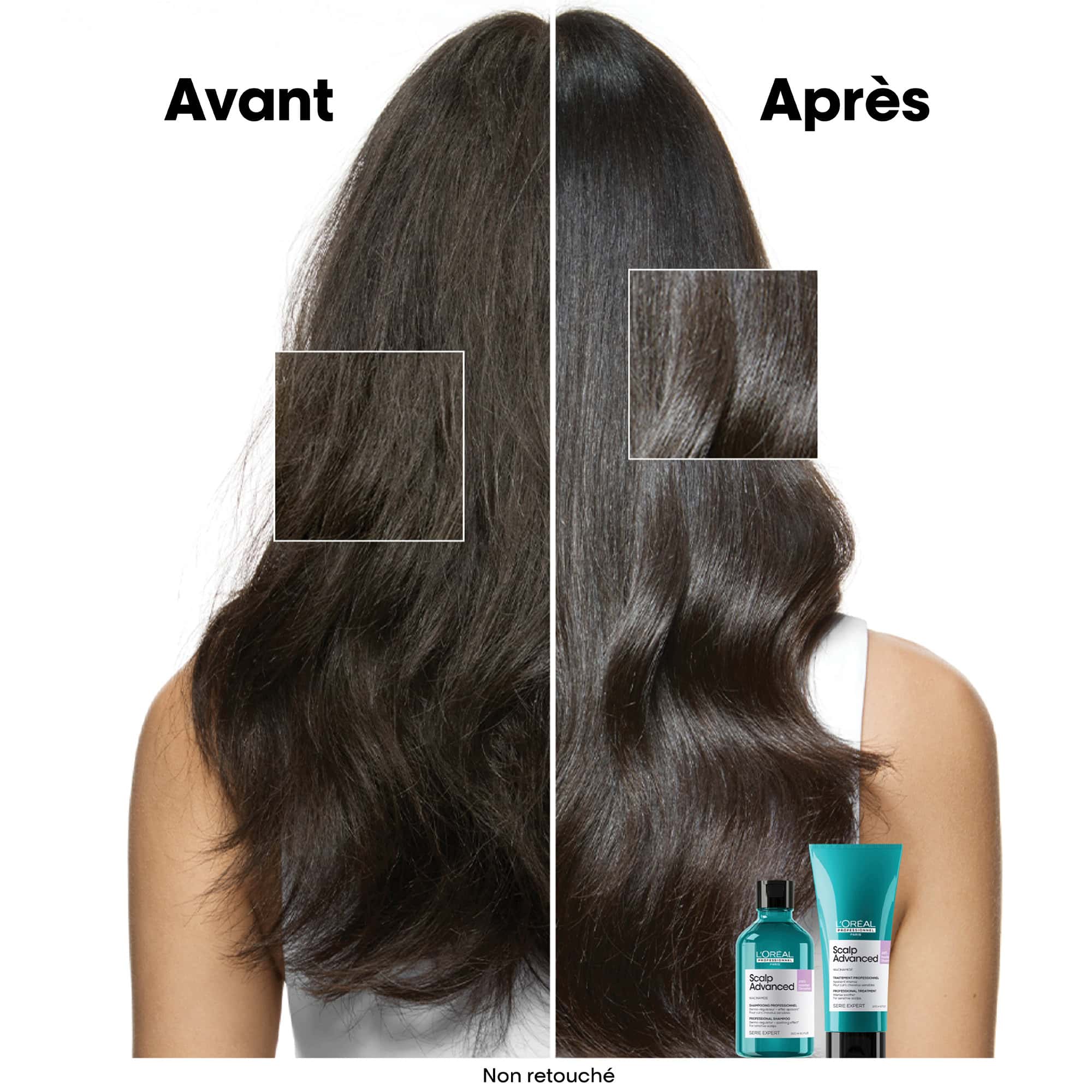 L'Oréal Professionnel Scalp Advanced Anti-Inconfort Pochette de Recharge Shampooing - 500ml - Image 2