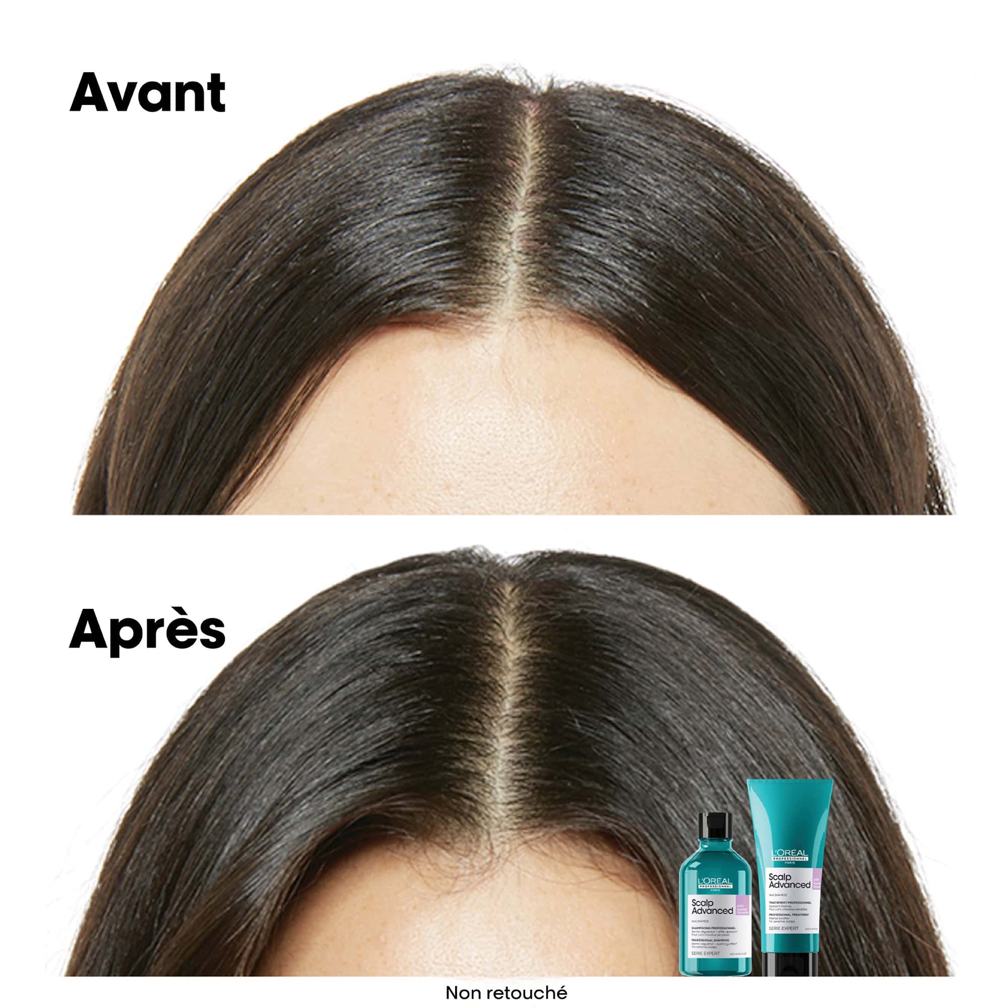 L'Oréal Professionnel Scalp Advanced Anti-Inconfort Pochette de Recharge Shampooing - 500ml - Image 3
